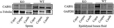 The metabolomics changes in epididymal lumen fluid of CABS1 deficient male mice potentially contribute to sperm deformity